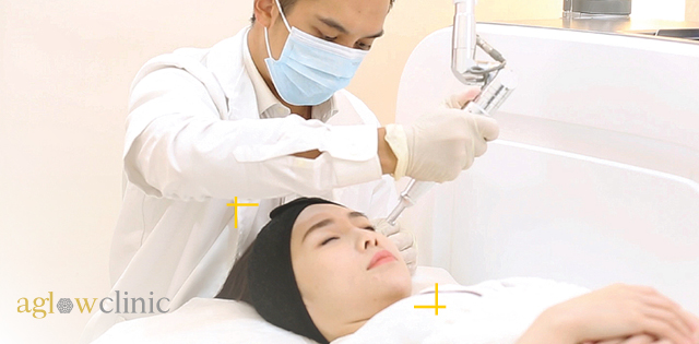 Advanced aesthetic  skin treatment at Aglow Clinic